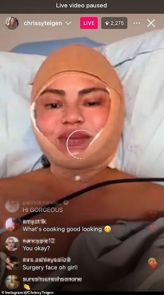 The details of Chrissy Teigens surgery come to light
