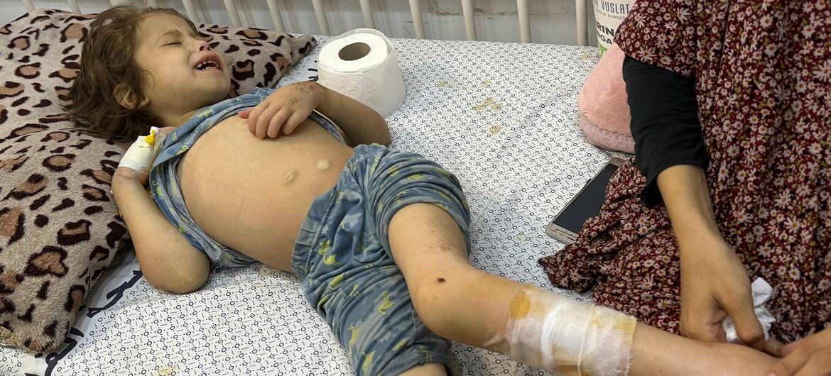 Janah, seven, is treated in the patient friendly with the patient hospital in the city of Gaza. Janah, seven, is treated in the patient friendly with the patient hospital in the city of Gaza.