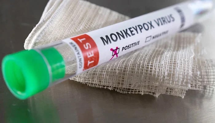 TEST TUBE The positive monkeoypox virus is seen in this illustration taken on May 22, 2022. - Reuters