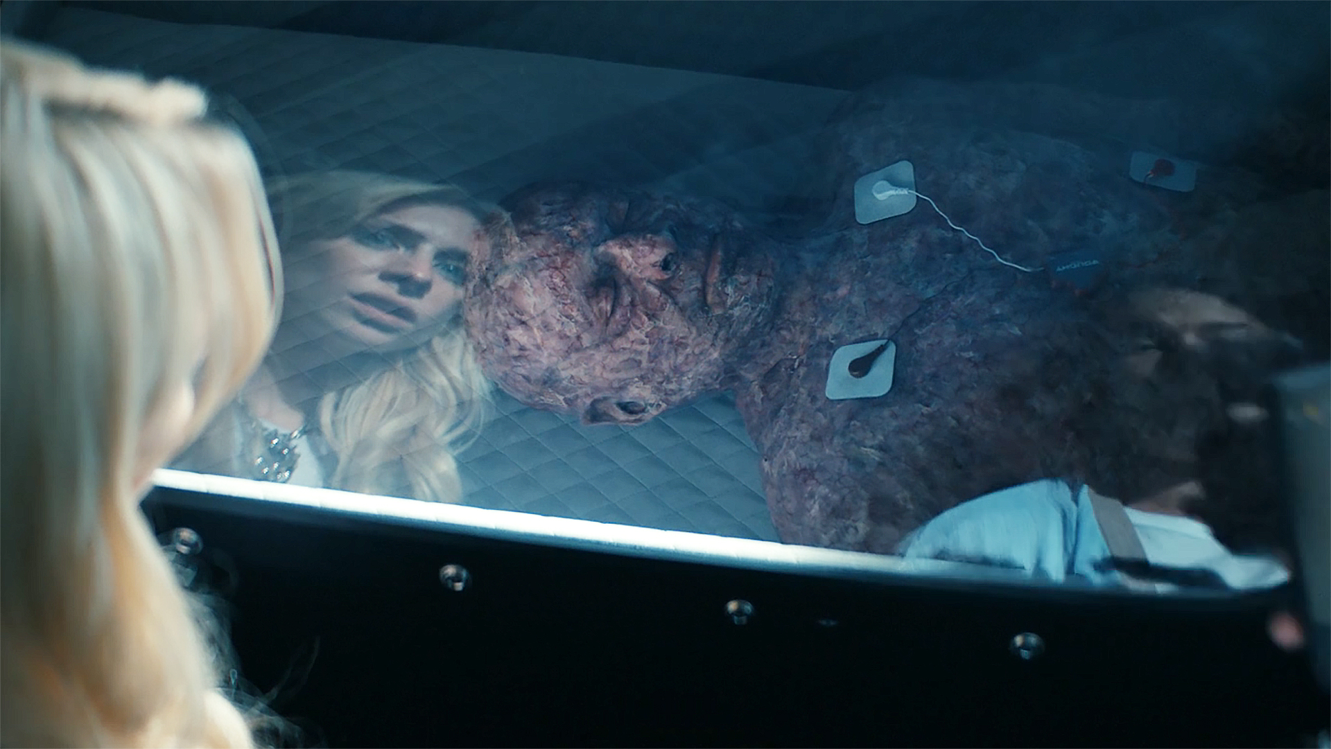 Cate and Jordan looking at a man with scars in a hyperbaric chamber in episode 4 of season 2 of generation V