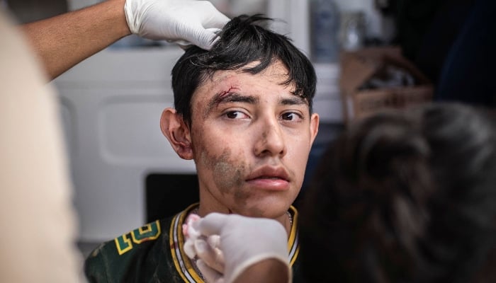 A young man receives medical attention in the municipality of Álamo, Veracruz state, Mexico, on October 12, 2025. — AFP