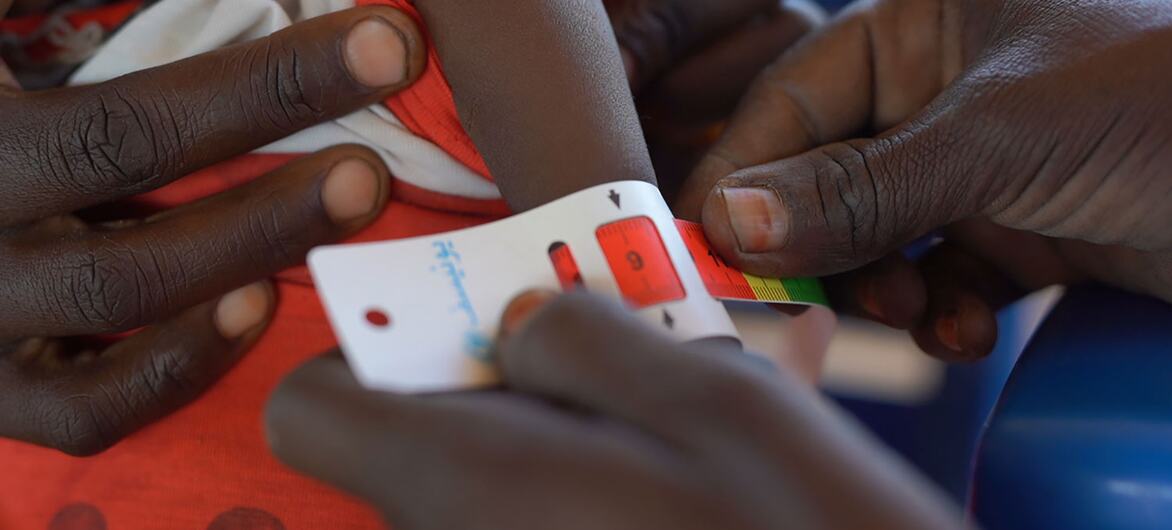 A close-up of hands using a tape measure to assess the arm circumference of a child at a UNICEF-supported nutrition center in Tawila, North Darfur, Sudan, for early detection of malnutrition.