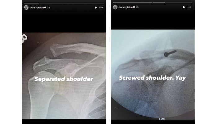 Channing Tatum prepares to undergo surgery after serious injury