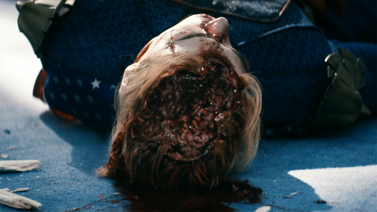 A close-up of Homelander's corpse with his brain on display in The Boys series finale